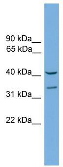 WB Suggested Anti-Fkhl18 Antibody Titration: 0.2-1 ug/ml; Positive Control: Mouse Brain