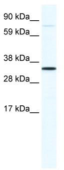 WB Suggested Anti-MSX1 Antibody Titration: 1.25 ug/ml; ELISA Titer: 1:62500; Positive Control: SP2/0 cell lysate