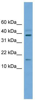 WB Suggested Anti-Atoh7 Antibody Titration: 0.2-1 ug/ml; Positive Control: Mouse Heart