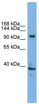 WB Suggested Anti-Atp6v0a1 Antibody Titration: 0.2-1 ug/ml; Positive Control: Mouse Uterus