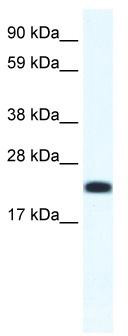 WB Suggested Anti-CITED4 Antibody Titration: 1.25 ug/ml; ELISA Titer: 1:1562500; Positive Control: SP2/0 cell lysate