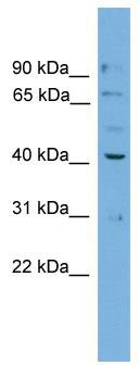 WB Suggested Anti-Dnajb12 Antibody Titration: 0.2-1 ug/ml; Positive Control: SP2/0 cell lysate