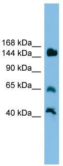 WB Suggested Anti-Jarid2 Antibody Titration: 0.2-1 ug/ml; ELISA Titer: 1:1562500; Positive Control: Mouse Liver