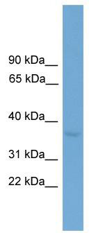 WB Suggested Anti-Zfp444 Antibody Titration: 0.2-1 ug/ml; Positive Control: Mouse Muscle