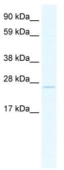 WB Suggested Anti-TCF23 Antibody Titration: 2.5ug/ml; ELISA Titer: 1:62500; Positive Control: SP2/0 cell lysate
