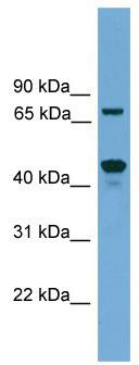 WB Suggested Anti-Zkscan17 Antibody Titration: 0.2-1 ug/ml; Positive Control: SP2/0 cell lysate