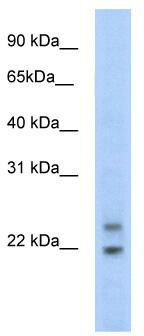 WB Suggested Anti-C330003B14RIK Antibody Titration: 5.0ug/ml; Positive Control: SP2/0 cell lysate