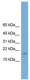 WB Suggested Anti-A830053O21Rik Antibody Titration: 0.2-1 ug/ml; Positive Control: Mouse Brain
