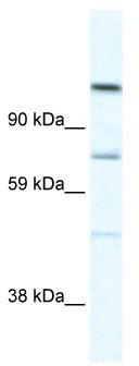 WB Suggested Anti-D930005D10RIK Antibody Titration: 5.0 ug/ml; ELISA Titer: 1:62500; Positive Control: SP2/0 cell lysate