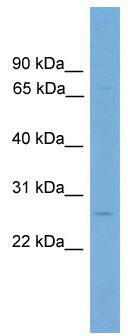 WB Suggested Anti-Slc2a12 Antibody Titration: 0.2-1 ug/ml; Positive Control: Mouse Spleen