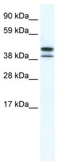 WB Suggested Anti-TRF3 Antibody Titration: 5.0ug/ml; ELISA Titer: 1:1562500; Positive Control: SP2/0 cell lysate