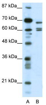 WB Suggested Anti-KCNK5 Antibody Titration: 0.2-1 ug/ml; ELISA Titer: 1:62500; Positive Control: HepG2 cell lysate