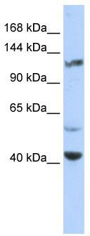 WB Suggested Anti-KCNH3 Antibody Titration: 0.2-1 ug/ml; ELISA Titer: 1:62500; Positive Control: Hela cell lysate