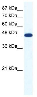 WB Suggested Anti-ACCN5 Antibody Titration: 1.25ug/ml; ELISA Titer: 1:312500; Positive Control: Jurkat cell lysate
