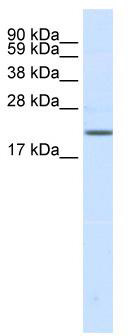 WB Suggested Anti-SCN3B Antibody Titration: 0.2-1 ug/ml; ELISA Titer: 1:12500; Positive Control: Human brain