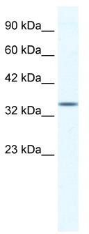 WB Suggested Anti-ZFP589 Antibody Titration: 1.25ug/ml; ELISA Titer: 1: 1562500; Positive Control: HepG2 cell lysate
