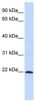 WB Suggested Anti-ZNF581 Antibody Titration: 0.2-1 ug/ml; ELISA Titer: 1: 312500; Positive Control: HepG2 cell lysate