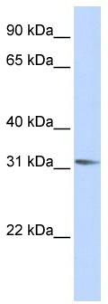 WB Suggested Anti-RHOXF2 Antibody Titration: 0.2-1 ug/ml; ELISA Titer: 1: 1562500; Positive Control: Hela cell lysate