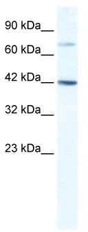 WB Suggested Anti-GLI4 Antibody Titration: 1.25ug/ml; ELISA Titer: 1: 312500; Positive Control: Jurkat cell lysate