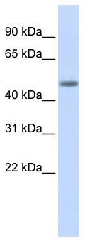 WB Suggested Anti-LASS5 Antibody Titration: 0.2-1 ug/ml; ELISA Titer: 1: 62500; Positive Control: Human Pancreas