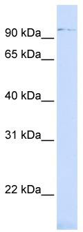 WB Suggested Anti-ZNF598 Antibody Titration: 0.2-1 ug/ml; ELISA Titer: 1: 62500; Positive Control: 721_B cell lysate