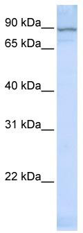 WB Suggested Anti-ZNF598 Antibody Titration: 0.2-1 ug/ml; ELISA Titer: 1: 312500; Positive Control: MCF7 cell lysate