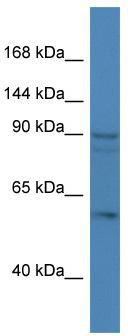 Host: Rabbit; Target Name: ERCC6; Sample Tissue: HepG2 Whole cell lysates; Antibody Dilution: 1.0 ug/ml