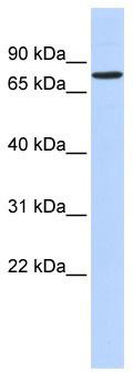 WB Suggested Anti-RFX2 Antibody Titration: 0.2-1 ug/ml; ELISA Titer: 1: 1562500; Positive Control: 721_B cell lysate