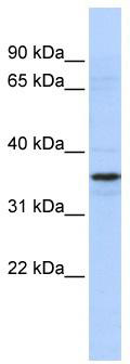 WB Suggested Anti-TADA2L Antibody Titration: 0.2-1 ug/ml; ELISA Titer: 1: 312500; Positive Control: Jurkat cell lysate.TADA2A is strongly supported by BioGPS gene expression data to be expressed in Jurkat