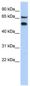 WB Suggested Anti-TADA2L Antibody Titration: 0.2-1 ug/ml; ELISA Titer: 1: 312500; Positive Control: HepG2 cell lysate