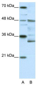 WB Suggested Anti-HTLF Antibody Titration: 0.2-1 ug/ml; ELISA Titer: 1: 62500; Positive Control: HepG2 cell lysate