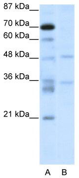 WB Suggested Anti-HTLF Antibody Titration: 2.5 ug/ml; ELISA Titer: 1: 1562500; Positive Control: Jurkat cell lysate