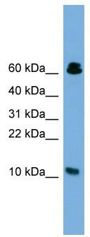 WB Suggested Anti-SUPT4H1 Antibody Titration: 0.2-1 ug/ml; ELISA Titer: 1: 312500; Positive Control: 293T cell lysate