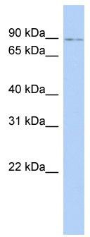 WB Suggested Anti-NFE2L1 Antibody Titration: 0.2-1 ug/ml; ELISA Titer: 1: 312500; Positive Control: Human Spleen