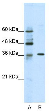 WB Suggested Anti-ZNF124 Antibody Titration: 2.5 ug/ml; ELISA Titer: 1: 312500; Positive Control: Jurkat cell lysate