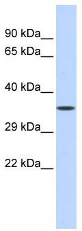 WB Suggested Anti-ZNF124 Antibody Titration: 0.2-1 ug/ml; ELISA Titer: 1: 312500; Positive Control: Human Liver