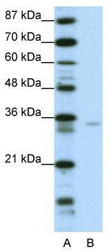 WB Suggested Anti-ZNF177 Antibody Titration: 0.0625 ug/ml; ELISA Titer: 1: 312500; Positive Control: Transfected 293T