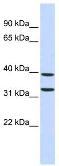 WB Suggested Anti-ZNF177 Antibody Titration: 0.2-1 ug/ml; ELISA Titer: 1: 62500; Positive Control: Human Pancreas