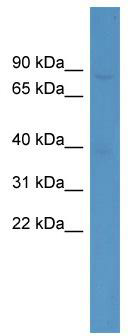 WB Suggested Anti-ZNF189 Antibody Titration: 0.2-1 ug/ml; ELISA Titer: 1: 1562500; Positive Control: HepG2 cell lysate; ZNF189 is supported by BioGPS gene expression data to be expressed in HepG2