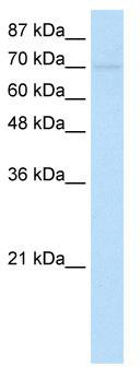 WB Suggested Anti-ZNF282 Antibody Titration: 1.25 ug/ml; ELISA Titer: 1: 312500; Positive Control: Transfected 293T