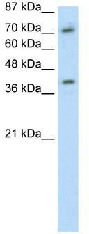 WB Suggested Anti-ZNF282 Antibody Titration: 1.25 ug/ml; ELISA Titer: 1: 312500; Positive Control: Transfected 293T