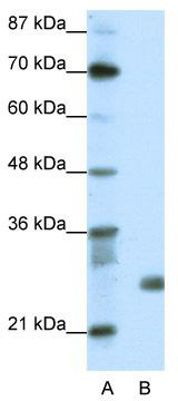 WB Suggested Anti-SAP30 Antibody Titration: 1.25 ug/ml; ELISA Titer: 1: 312500; Positive Control: Transfected 293T