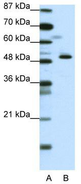 WB Suggested Anti-ZNF259 Antibody Titration: 0.2-1 ug/ml; ELISA Titer: 1: 312500; Positive Control: Jurkat cell lysate; ZNF259 is supported by BioGPS gene expression data to be expressed in Jurkat