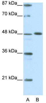 WB Suggested Anti-ZNF259 Antibody Titration: 0.03 ug/ml; ELISA Titer: 1: 312500; Positive Control: Jurkat cell lysate; ZNF259 is supported by BioGPS gene expression data to be expressed in Jurkat