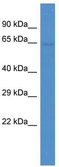 Host: Rabbit; Target Name: ZNF284; Sample Tissue: OVCAR-3 Whole cell lysates; Antibody Dilution: 1.0 ug/ml