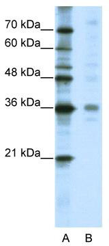WB Suggested Anti-CRSP8 Antibody Titration: 5.0 ug/ml; ELISA Titer: 1: 62500; Positive Control: HepG2 cell lysate