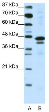 WB Suggested Anti-WDR39 Antibody Titration: 0.2-1 ug/ml; ELISA Titer: 1: 312500; Positive Control: Jurkat cell lysate; CIAO1 is supported by BioGPS gene expression data to be expressed in Jurkat
