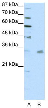 WB Suggested Anti-PITX3 Antibody Titration: 0.2-1 ug/ml; ELISA Titer: 1: 1562500; Positive Control: HepG2 cell lysate