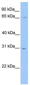 Immunohistochemistry of paraffin-embedded Human tonsil tissue using TA372944 (ACP5 Antibody) at dilution 1/50 (Original magnification: ×200)