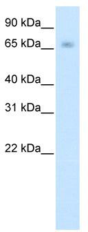 WB Suggested Anti-KBTBD10 Antibody Titration: 0.625 ug/ml; ELISA Titer: 1: 1562500; Positive Control: Human Muscle